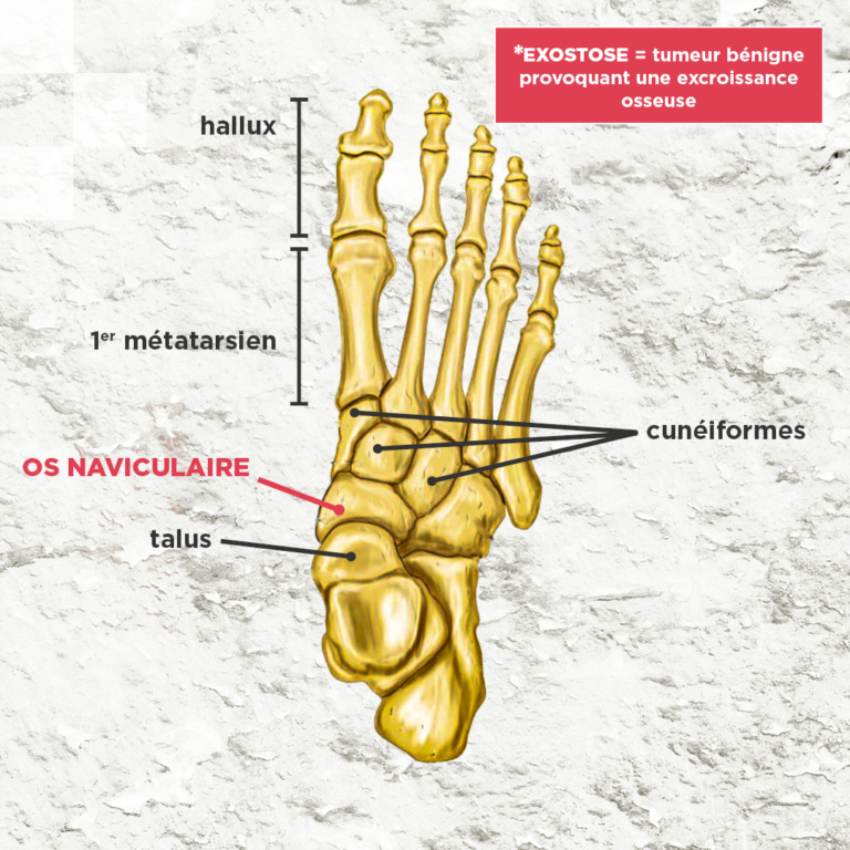 Navicular2